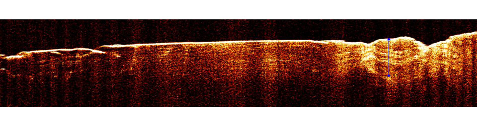 PIA09095: Radar View of Layering near Mars' South Pole, Orbit 1360