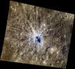 PIA15389: Say Aah!